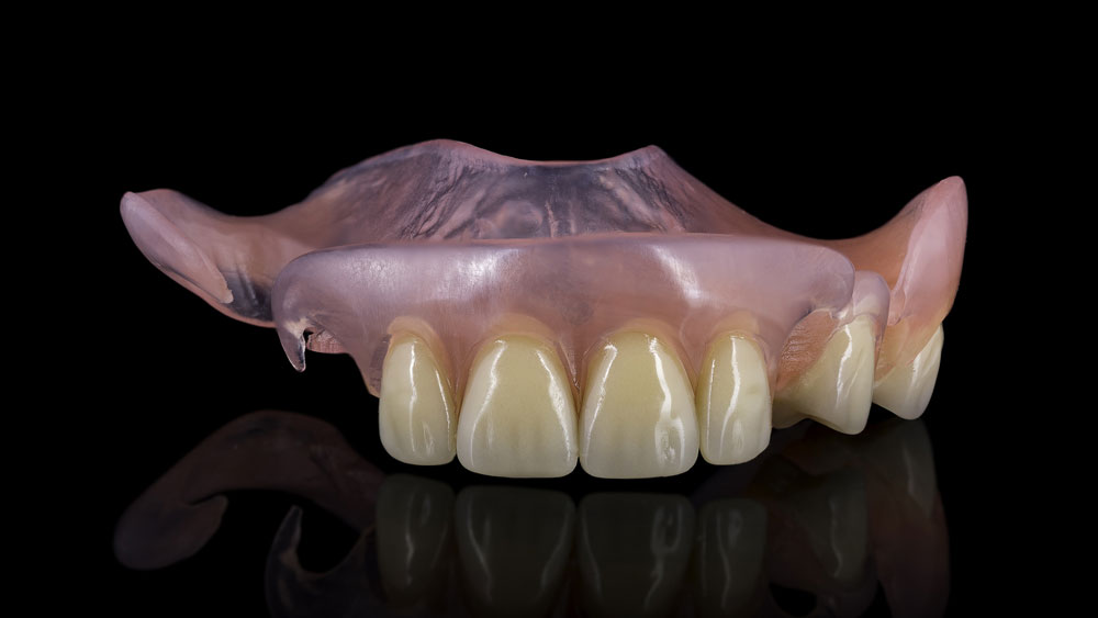 Basil-Dental-Laboratory_Service_flexi-partial-dentures