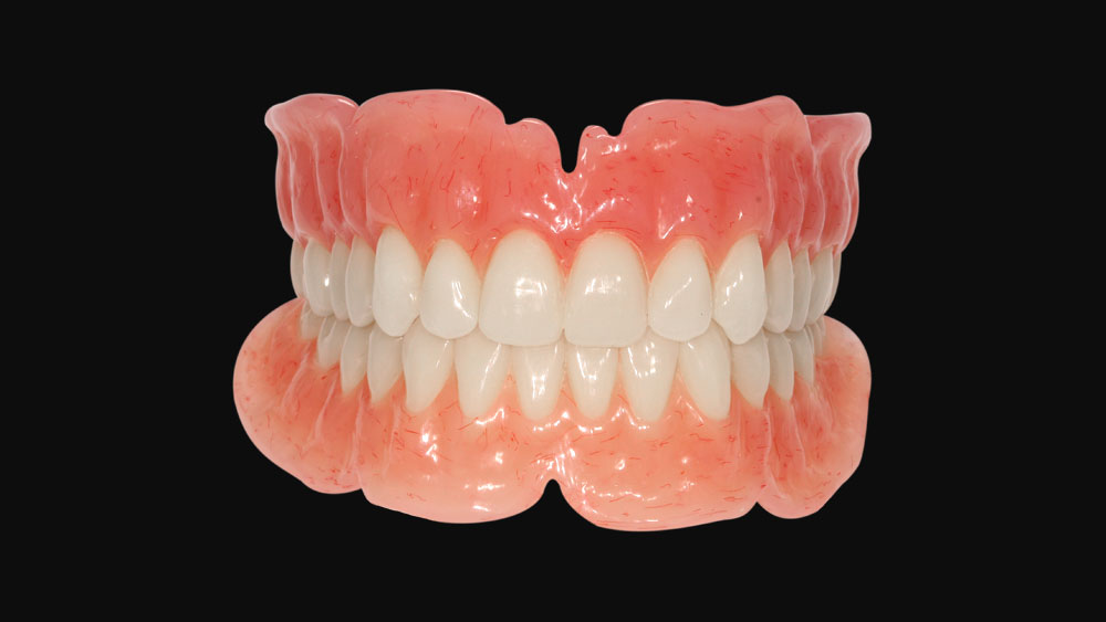 Basil-Dental-Laboratory_Service_full-denture